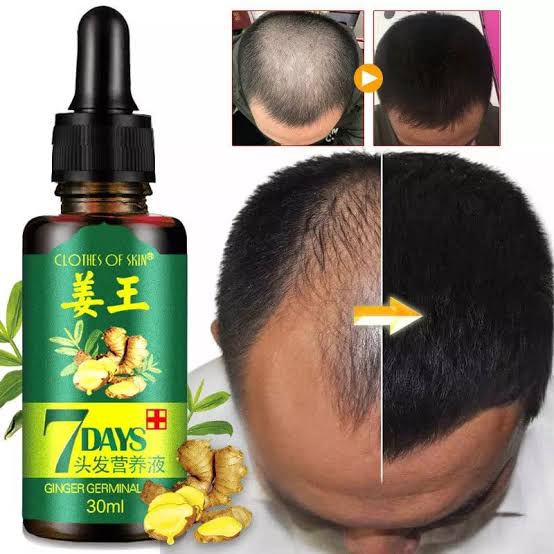 7 Days Hair Growth Germinal Serum Oil (30ML) ZE Enterprises