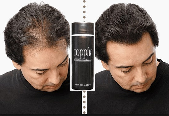 Toppik Hair Fiber 27.5g - BLACK and DARK BROWN ZE Enterprises